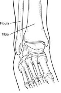 ankle fractures