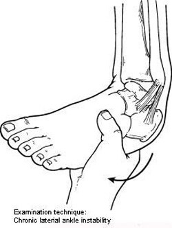 chronic ankle instability