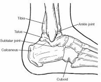 fractures of the calcaneus